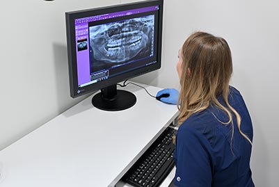 Stomatolog sprawdzający na komputerze zdjęcie rtg szczęki pacjenta
